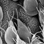 el intestino irritable y autismo Giardia lamblia